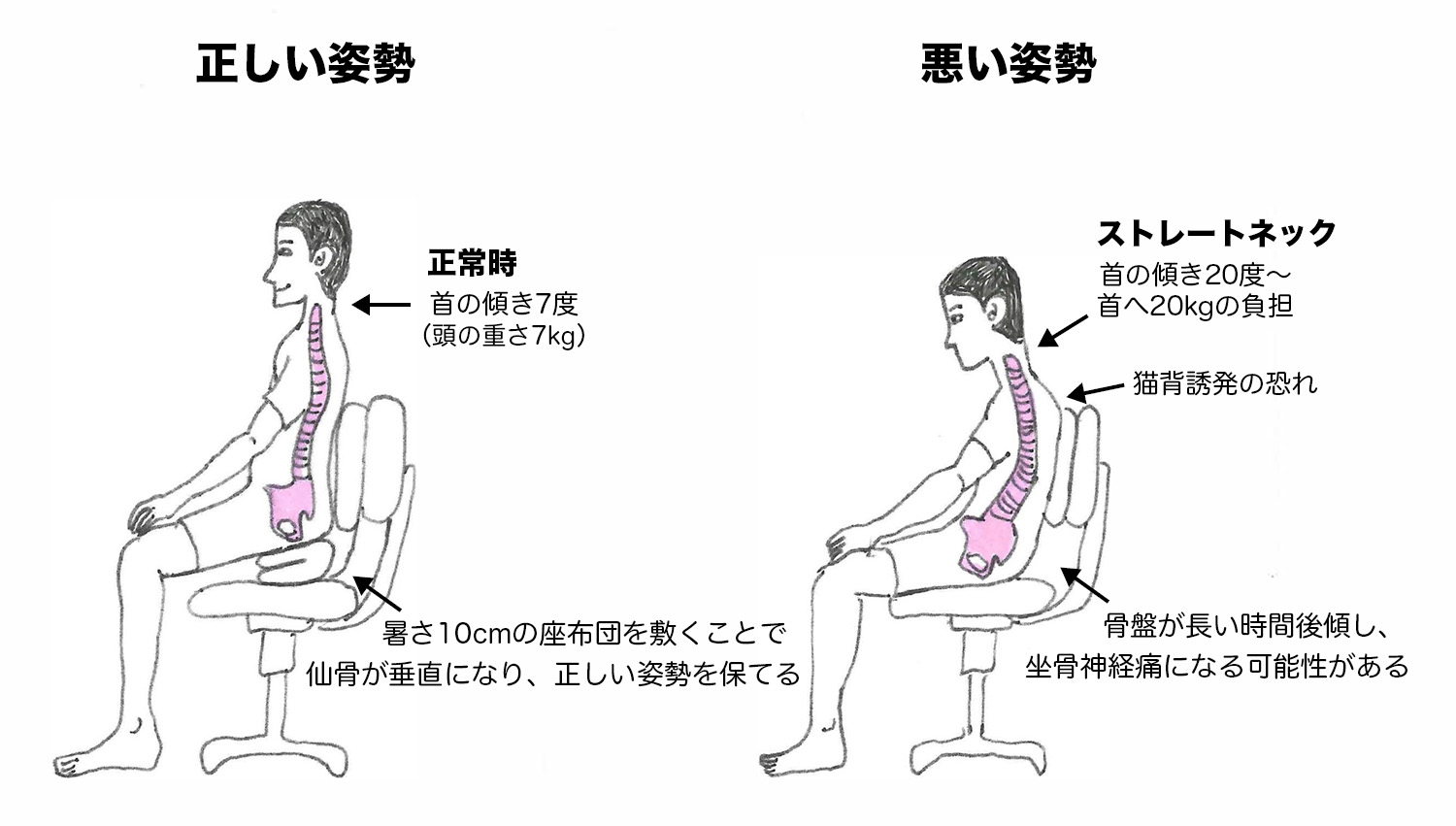 坐骨神経痛を予防および緩和する生活習慣